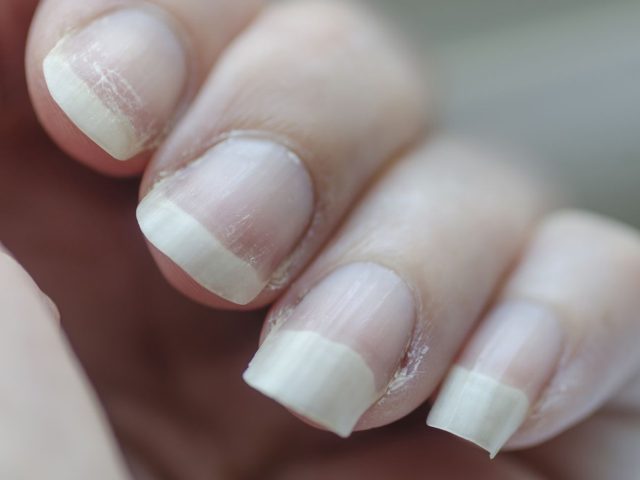 Guide to Caring for Fragile, Brittle Nails: How to Strengthen and Restore Healthy, Beautiful Nails